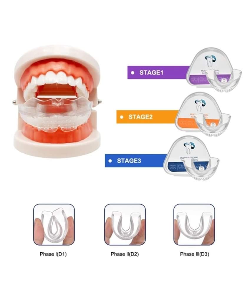 Bright Smile 3 Piece Tooth Orthodontic Appliance, Professional Alignment Brace Mouthpiece Teeth Retainer for Adult Teeth Care