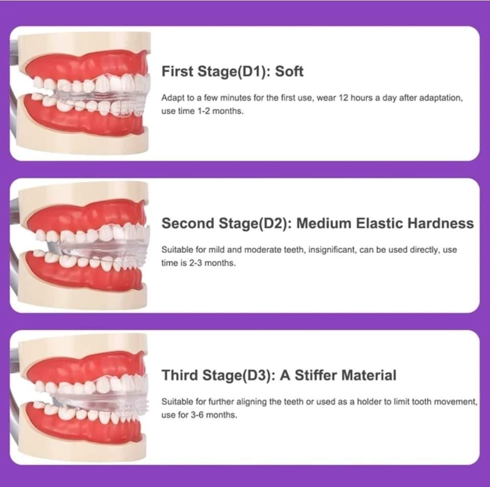 Bright Smile 3 Piece Tooth Orthodontic Appliance, Professional Alignment Brace Mouthpiece Teeth Retainer for Adult Teeth Care